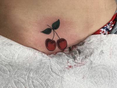 Cherries on the pelvis 