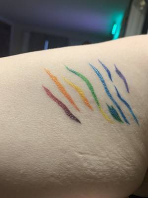 Healed rainbow filled stretch marks 