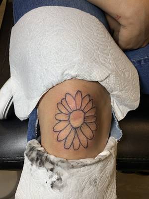 Daisy on the knee 