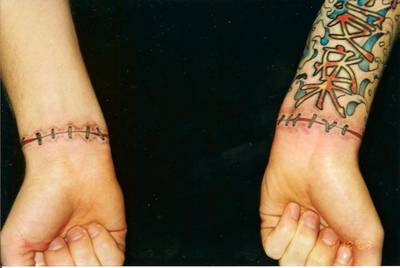 Open Wounds