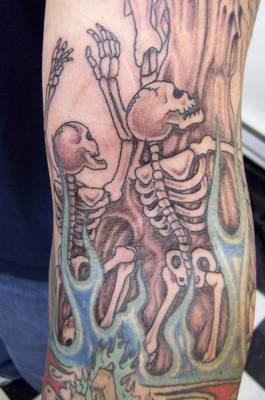 Skeletal